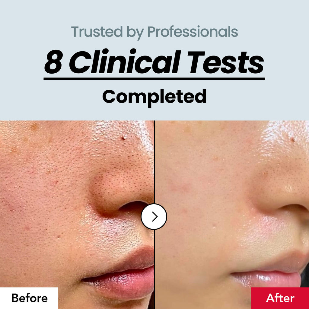[Korea’s #1 Skincare] Skin Texture Serum