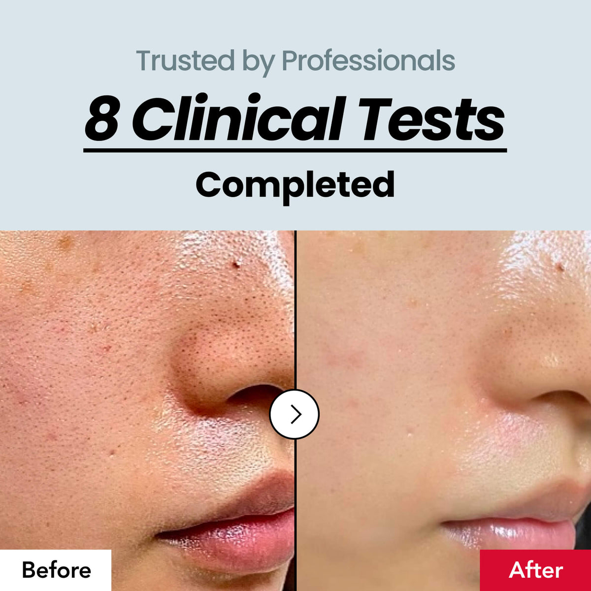 [Korea’s #1 Skincare] Skin Texture Serum